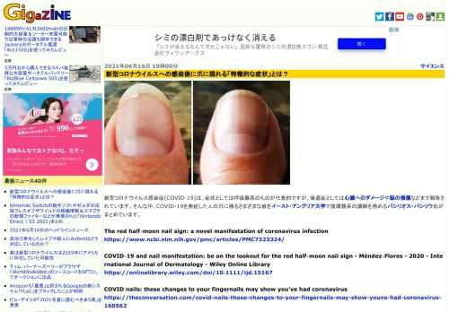新型コロナウイルス感染症(COVID-19)は、症状としては呼吸器系のものが代表的ですが、後遺症としては心臓へのダメージや脳の損傷などまで報告されています。そんな中、COVID-19を発症した人の爪に残るさまざまな痕をイースト・アングリア大学で循環器系の講師を務めるバシリオス・バシリウ氏がまとめています。