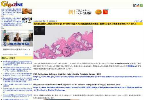 アメリカ食品医薬局(FDA)が2021年9月21日に、前立腺のスキャン画像からがんを特定するよう設計されたAIの「Paige Prostate」を承認し、専門医を補助するソフトウェアとして市販することを許可したと発表しました。これにより、男性のがんとしては患者数・死亡率ともに上位の前立腺がんの検査件数や検査精度が大きく向上すると期待されています。