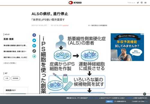 体が徐々に動かせなくなる難病「筋萎縮性側索硬化症（ALS）」の治療に有効な既存薬を患者の人工多能性幹...