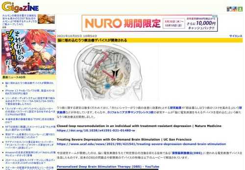 うつ病に関する研究は数多く行われており、「冷たいシャワーがうつ病の改善に効果的」とする研究結果や「都会暮らしはうつ病のリスクを高める」という研究結果などが存在しています。そんな中、カリフォルニア大学サンフランシスコ校の研究チームが「脳に電気刺激を与えるデバイスを埋め込む」という新たなうつ病治療法を開発しました。