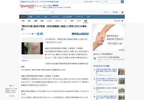 コロナ禍のなか、「帯状ほう疹」の患者が急増したと言います。一体なぜなのでしょうか。  近畿大学医学部皮膚科学教室　大塚篤司　主任教授 「私が近畿大学で患者さんを診ている限りでは、去年の春から夏にかけ