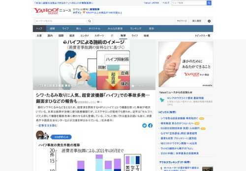 顔のシワなどを取るため、超音波を照射するHIFU（ハイフ）という機器を使った事故が相次いでいる。本来は医師が治療に使う医療機器だが、エステサロンの施術でも使われ、「セルフハイフ」と称して顧客自身に使わせる店も登場している。