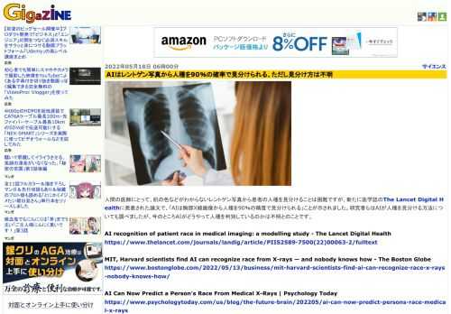 人間の医師にとって、肌の色などがわからないレントゲン写真から患者の人種を見分けることは困難ですが、新たに医学誌のThe Lancet Digital Healthに発表された論文で、「AIは胸部X線画像から人種を90％の精度で見分けられる」ことが示されました。研究者らはAIが人種を見分ける方法についても調べましたが、今のところAIがどうやって人種を判別しているのかは不明とのことです。